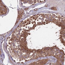 Invitrogen MFSD8 Polyclonal Antibody 100 &mu;L; Unconjugated:Antibodies,