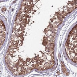 Invitrogen MFSD8 Polyclonal Antibody 100 &mu;L; Unconjugated:Antibodies,