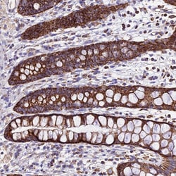 Invitrogen OCIAD1 Polyclonal Antibody 100 &mu;L; Unconjugated:Antibodies,