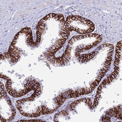 Invitrogen OR1Q1 Polyclonal Antibody 100 &mu;L; Unconjugated:Antibodies,