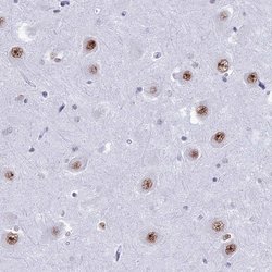 Invitrogen U2AF1 Polyclonal Antibody 100 &mu;L; Unconjugated:Antibodies,