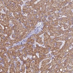 Invitrogen MGST1 Polyclonal Antibody 100 &mu;L; Unconjugated:Antibodies,