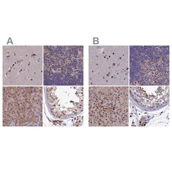 Invitrogen DNPEP Polyclonal Antibody 100 &mu;L; Unconjugated:Antibodies,