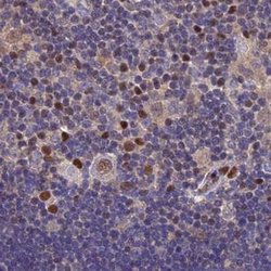 Invitrogen DNPEP Polyclonal Antibody 100 &mu;L; Unconjugated:Antibodies,