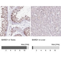 Invitrogen BARD1 Polyclonal Antibody 100 &mu;L; Unconjugated:Antibodies,