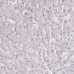 Invitrogen BARD1 Polyclonal Antibody 100 &mu;L; Unconjugated:Antibodies,