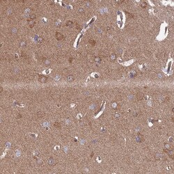 Invitrogen IA-6 Polyclonal Antibody 100 &mu;L; Unconjugated:Antibodies,