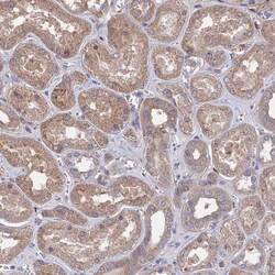 Invitrogen IA-6 Polyclonal Antibody 100 &mu;L; Unconjugated:Antibodies,
