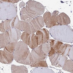 Invitrogen IA-6 Polyclonal Antibody 100 &mu;L; Unconjugated:Antibodies,