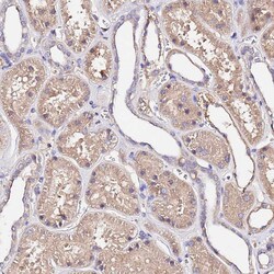 Invitrogen MTERF Polyclonal Antibody 100 &mu;L; Unconjugated:Antibodies,