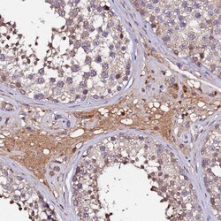 Invitrogen MTERF Polyclonal Antibody 100 &mu;L; Unconjugated:Antibodies,