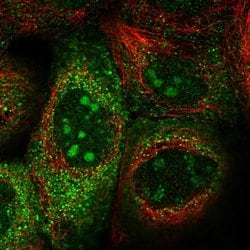 Invitrogen Dynactin 3 Polyclonal Antibody 100 &mu;L; Unconjugated:Antibodies,