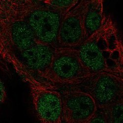TOR4A Polyclonal Antibody, Invitrogen 100 &mu;L; Unconjugated:Antibodies,