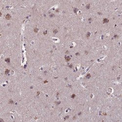 TOR4A Polyclonal Antibody, Invitrogen 100 &mu;L; Unconjugated:Antibodies,