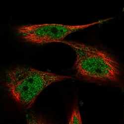 Invitrogen MIIP Polyclonal Antibody 100 &mu;L; Unconjugated:Antibodies,