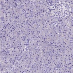 Invitrogen MIIP Polyclonal Antibody 100 &mu;L; Unconjugated:Antibodies,