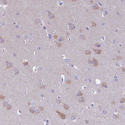 Invitrogen MIIP Polyclonal Antibody 100 &mu;L; Unconjugated:Antibodies,