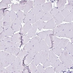 Invitrogen Cystatin M Polyclonal Antibody 100 &mu;L; Unconjugated:Antistoffer