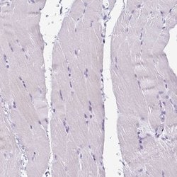 Invitrogen Cystatin M Polyclonal Antibody 100 &mu;L; Unconjugated:Antistoffer