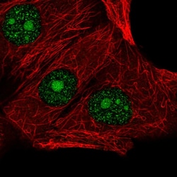 Invitrogen LSM3 Polyclonal Antibody 100 &mu;L; Unconjugated:Antibodies,