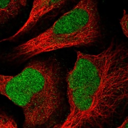 Invitrogen HMCES Polyclonal Antibody 100 &mu;L; Unconjugated:Antibodies,