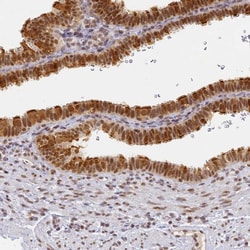 Invitrogen HMCES Polyclonal Antibody 100 &mu;L; Unconjugated:Antibodies,