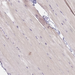 Invitrogen HMCES Polyclonal Antibody 100 &mu;L; Unconjugated:Antibodies,