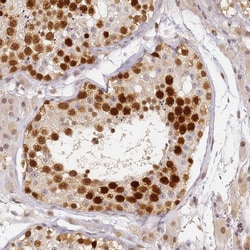 Invitrogen HMCES Polyclonal Antibody 100 &mu;L; Unconjugated:Antibodies,