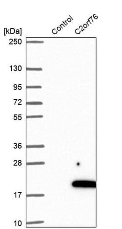 Invitrogen C2orf76 Polyclonal Antibody 100 &mu;L | Buy Online | Invitrogen&trade; | Fisher Scientific
