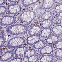 Invitrogen RNASE2 Polyclonal Antibody 100 &mu;L; Unconjugated:Antibodies,