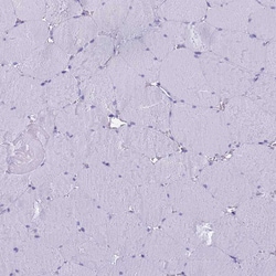 Invitrogen RNASE2 Polyclonal Antibody 100 &mu;L; Unconjugated:Antibodies,