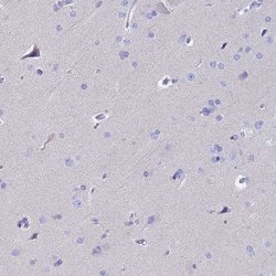Invitrogen RNASE2 Polyclonal Antibody 100 &mu;L; Unconjugated:Antibodies,