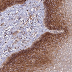 Invitrogen OR5T3 Polyclonal Antibody 100 &mu;L; Unconjugated:Antibodies,
