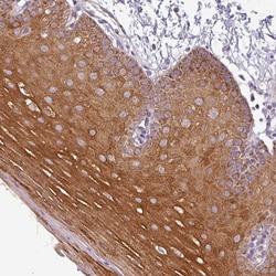 Invitrogen PNMA6A Polyclonal Antibody 100 &mu;L; Unconjugated:Antibodies,