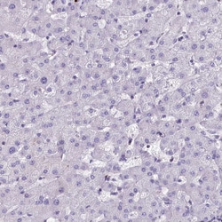 Invitrogen HLA-DOA Polyclonal Antibody 100 &mu;L; Unconjugated:Antibodies,