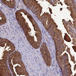 Invitrogen OR56B1 Polyclonal Antibody 100 &mu;L; Unconjugated:Antibodies,