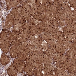 Invitrogen ZNF619 Polyclonal Antibody 100 &mu;L; Unconjugated:Antibodies,
