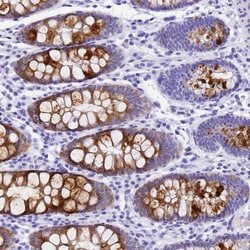 Invitrogen UGT2B4 Polyclonal Antibody 100 &mu;L; Unconjugated:Antibodies,