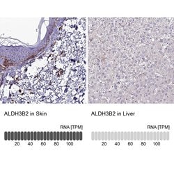 Invitrogen ALDH3B2 Polyclonal Antibody 100 &mu;L; Unconjugated:Antibodies,