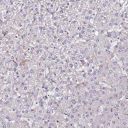 Invitrogen ALDH3B2 Polyclonal Antibody 100 &mu;L; Unconjugated:Antibodies,