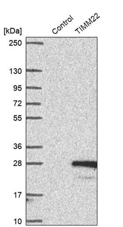 Invitrogen TIMM22 Polyclonal Antibody 100 &mu;L; Unconjugated:Antibodies,