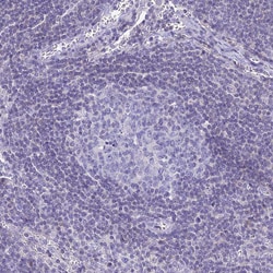 Invitrogen ZMIZ1 Polyclonal Antibody 100 &mu;L; Unconjugated:Antibodies,