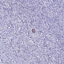 Invitrogen ZMIZ1 Polyclonal Antibody 100 &mu;L; Unconjugated:Antibodies,