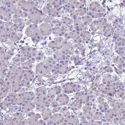 Invitrogen ZMIZ1 Polyclonal Antibody 100 &mu;L; Unconjugated:Antibodies,