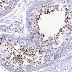 Invitrogen ZMIZ1 Polyclonal Antibody 100 &mu;L; Unconjugated:Antibodies,