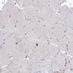 Invitrogen VAT1 Polyclonal Antibody 100 &mu;L; Unconjugated:Antibodies,