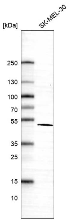 Invitrogen VAT1 Polyclonal Antibody 100 &mu;L; Unconjugated:Antibodies,