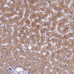 Invitrogen ASPHD1 Polyclonal Antibody 100 &mu;L; Unconjugated:Antibodies,