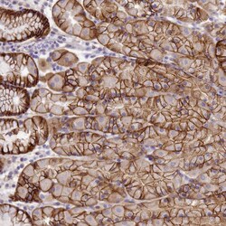 Invitrogen TBCD Polyclonal Antibody 100 &mu;L; Unconjugated:Antibodies,