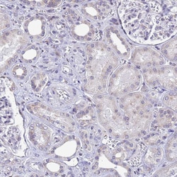 Invitrogen SSR4 Polyclonal Antibody 100 &mu;L; Unconjugated:Antibodies,